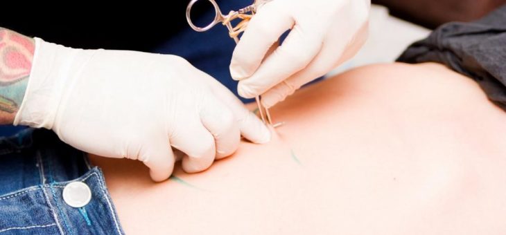 Medizinischer Expertenrat im Online-Chat: Tattoo und Piercing – Welche Risiken birgt der Körperschmuck?