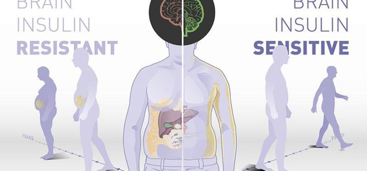 Insulinwirkung im Gehirn bestimmt das Körpergewicht und die Fettverteilung