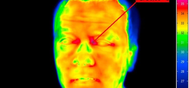 Wärmebildkameras zur Fieberdetektion in der Corona-Pandemie