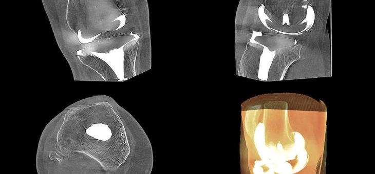 Perspektive DVT – Anwendung der DVT in der Grenzflächenbeurteilung