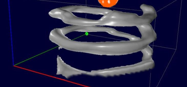 Vielfarbige Bildgebung mit magnetischen Nanopartikeln