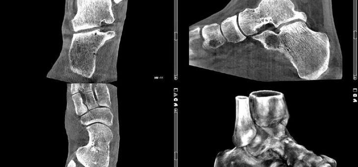 Perspektive DVT – Einsatz als Primärdiagnostik mit höchster Strahlenhygiene