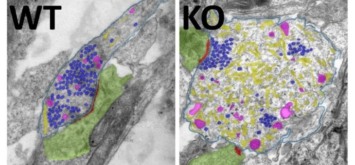 Überraschende Erkenntnisse zur Rolle der Autophagie in Nervenzellen