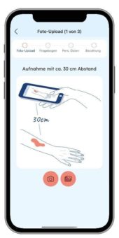 Versicherungskammer kooperiert mit Dermatologie-Startup „dermanostic“