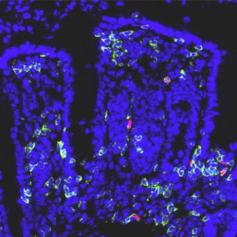 Neuer Sonderforschungsbereich an der Universitätsmedizin Mainz soll Grundlage für maßgeschneiderte Immuntherapien schaffen