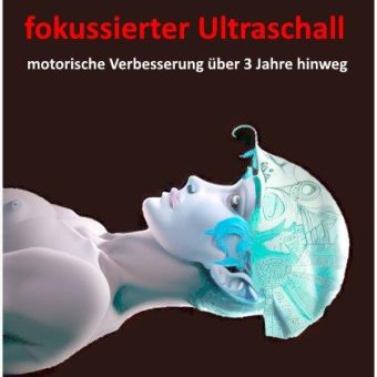 Fokussierter Ulltraschall bei Parkinson