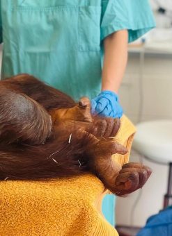 Rettung von Orang-Utan-Dame „Cinta“:  Ärztinnen des Krankenhauses Porz am Rhein führen Operation im Kölner Zoo erfolgreich durch