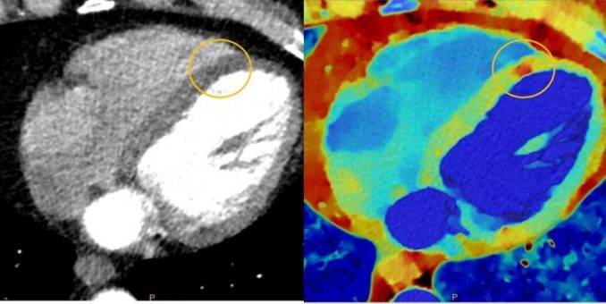 Schneller, schonender, kontrastreicher: Neuer Computertomograph am Universitätsklinikum Heidelberg kann mehr