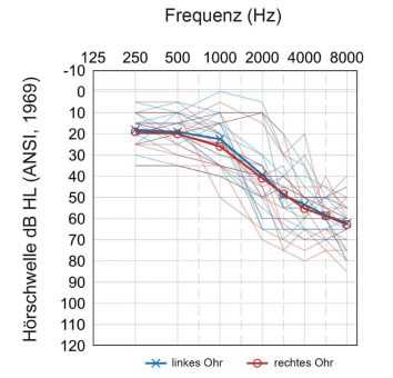 Wie die Widex Puresound-Signalverarbeitung neuronale Codierungen der Signal-Einhüllenden erleichtert