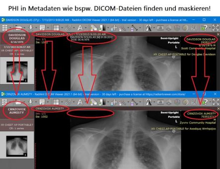 ❌ Patientendaten-Schutz-Gesetz ❌ Sensible PHI-Daten in DICOM, HL7 und X12-EDI-Dateien identifizieren und anonymisieren ❗