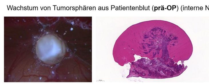 Gemeinschaftsprojekt im Kampf gegen Krebs